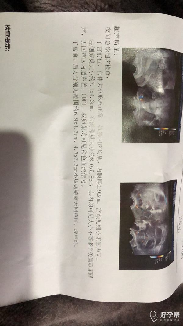 取卵后腹水的症状及其影响